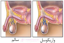 معجون واریکوسل وارداتی/طب سنتی هندی ایرانی ترکیب 16 گیاه +30 گرم ژل رویال گرید a