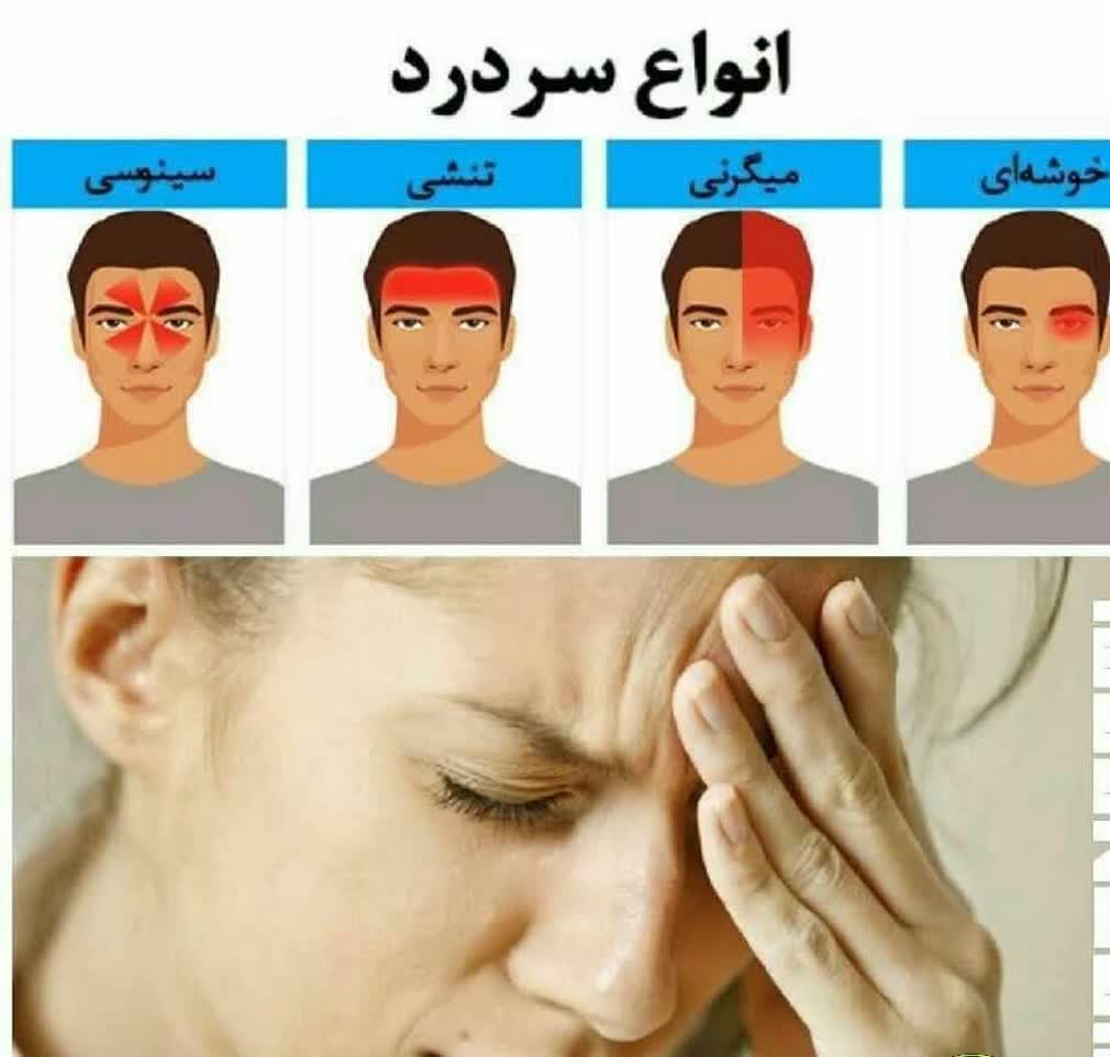 روغن هلکسیر درمان تسکین  سردرد و میگرن برند اکسونیک مستقیم از نمایندگی ایران زمین
