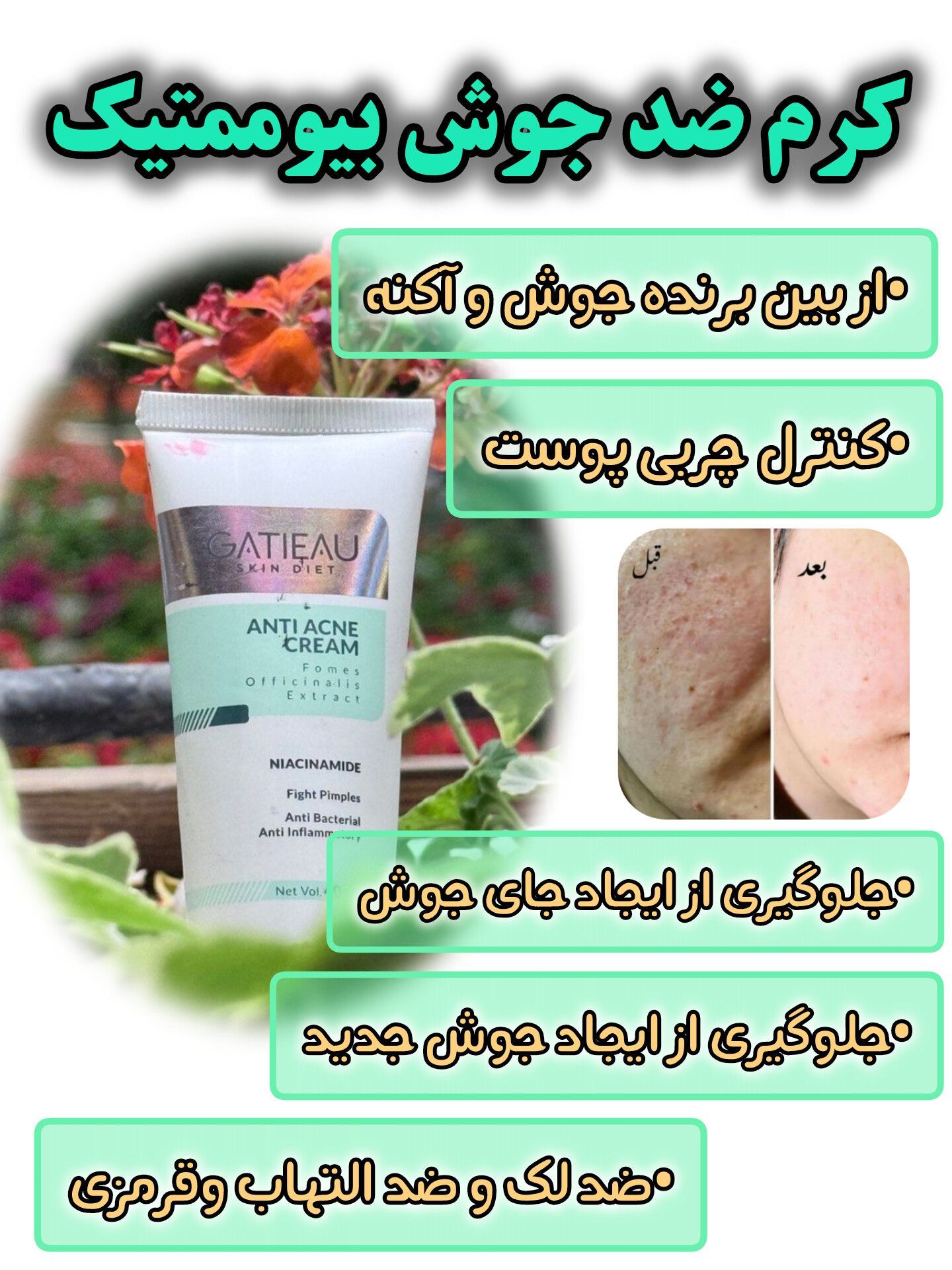 کرم بیوممتیک ضد جوش و ضدلک آنتی آکنه 40 میل گاتیو ایتالیا
